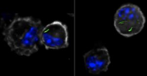 Mycobacterium tuberculosis-infected alveolar macrophages at day 10 after infection. Mtb in green.