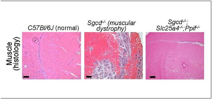 Gene deletions stop muscular dystrophy progression