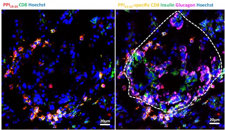 T cells in the pancreas