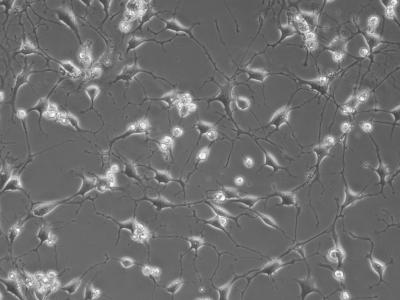 Brain-Like Cells Forming Complex Networks