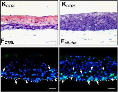 PPAR-beta/delta Modulates Fibroblast Response to Keratinocyte-Released IL-1