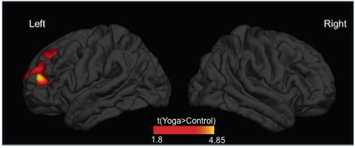 Differences in Cortical Thickness between Yoginis and Controls