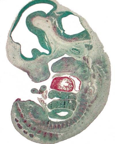 Fetal-Heart Cell Enzyme