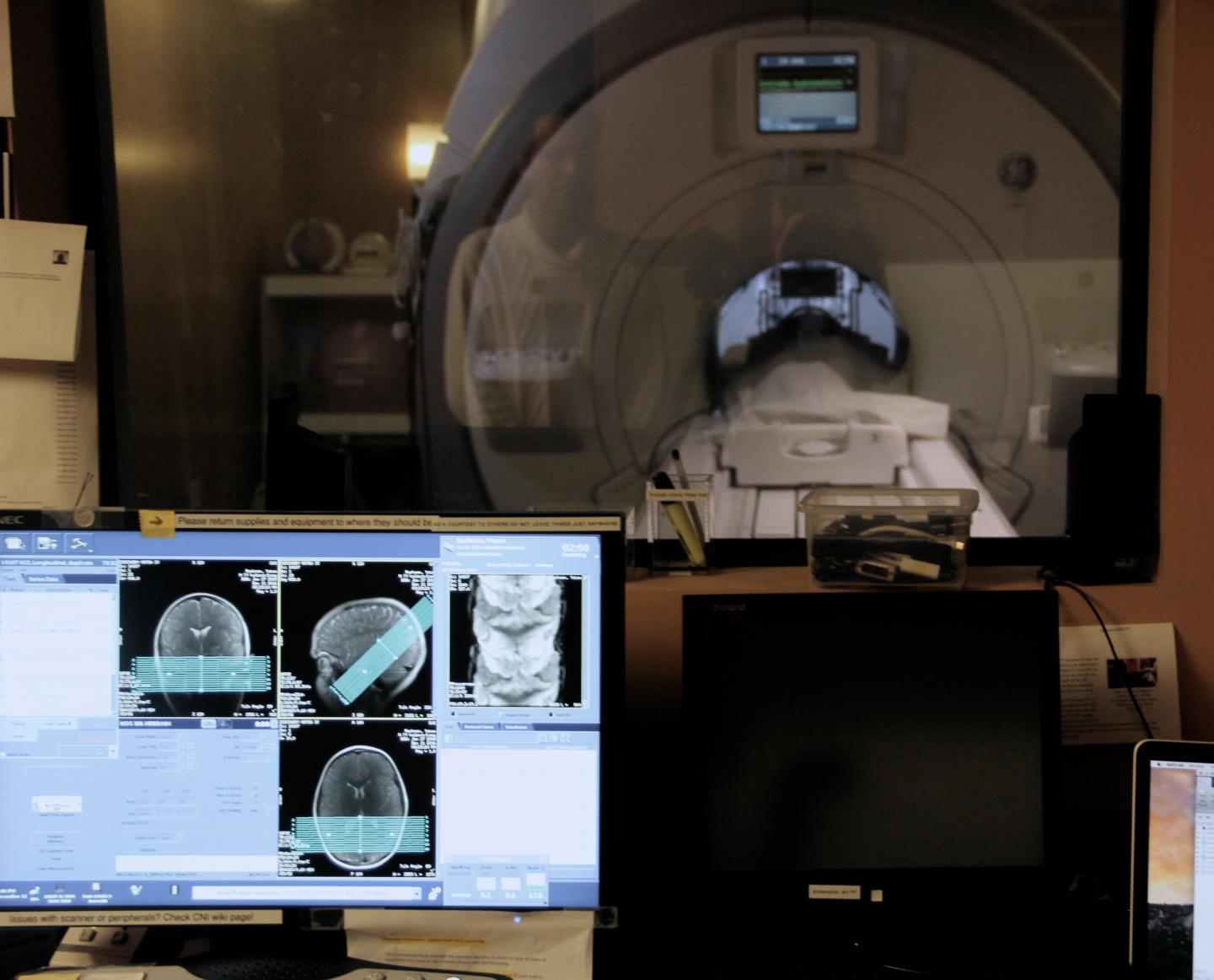 One Part of the Brain Unexpect [IMAGE] | EurekAlert! Science News Releases