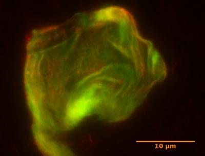 Fluorescent Micrograph of DNA Gel