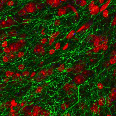 UNC Study Shows How 2 Brain Areas Interact to Trigger Divergent Emotional Behaviors