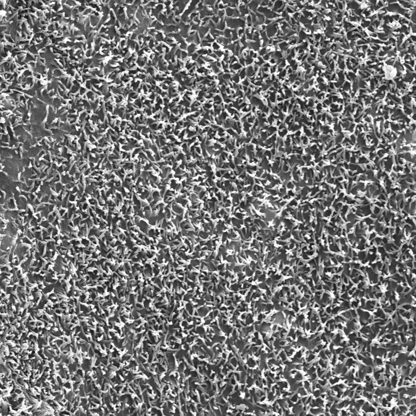 Mutated Brush Border