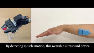 Wearable ultrasound monitor for muscle motion