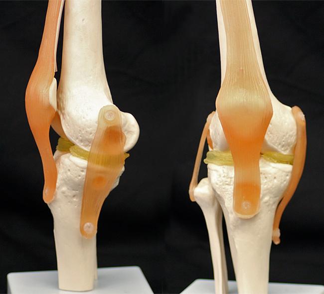 Knee Model [IMAGE] EurekAlert! Science News Releases