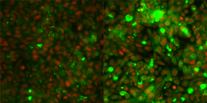 Colorectal cancer cells before and after chemotherapy