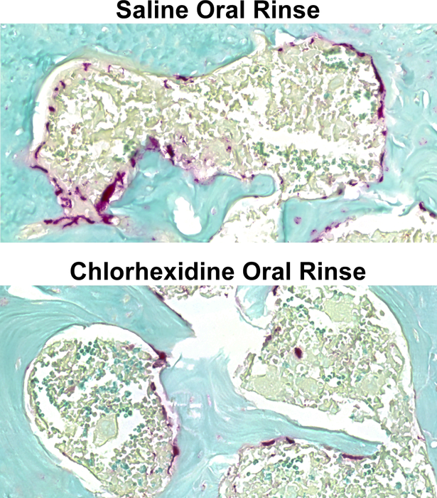 Osteoclasts are prevalent with the molar in the context of a normal oral microbiota.