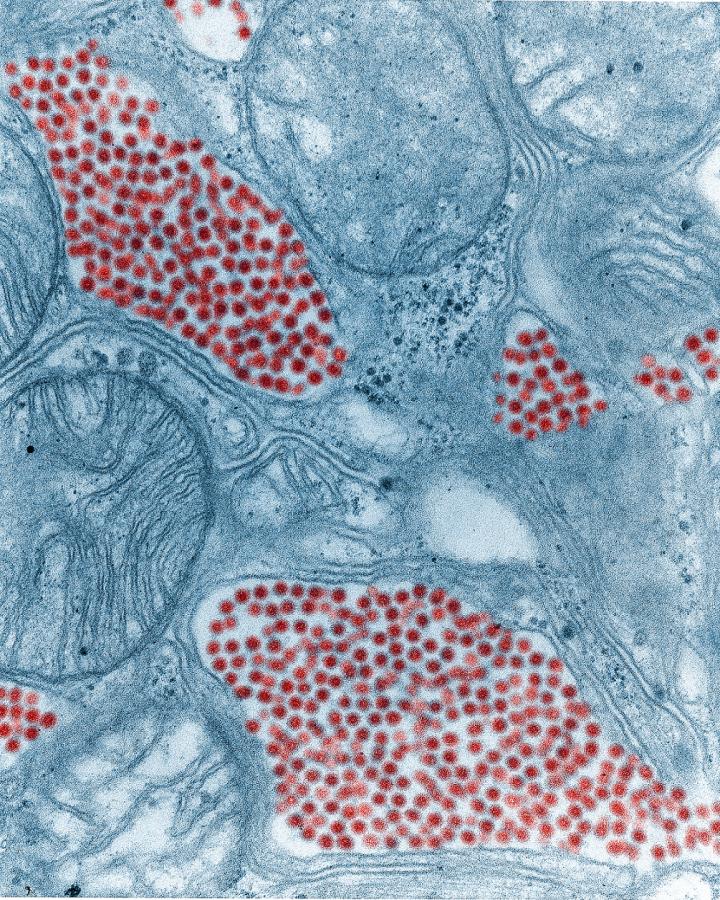 Colorized Image of Mosquito Salivary Gland Tissue Infected by the Eastern Equine Encephalitis Virus