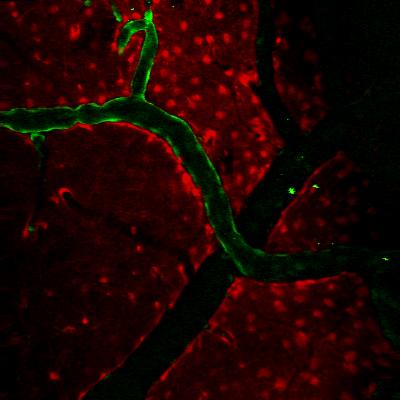 In-Vivo 2-Photon Microscopy Image of Endothelial Cells Lining Surface Arteries in the Brain