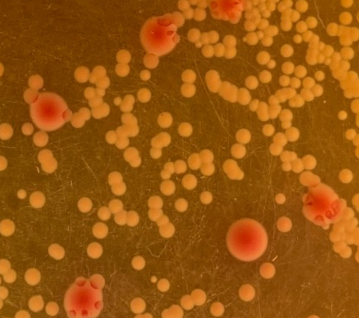 Klebsiella pneumoniae and Acin [IMAGE] EurekAlert! Science News Releases