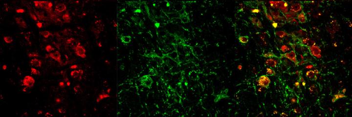 Cholinergic Neurons in Brain Stem Can Induce REM Sleep