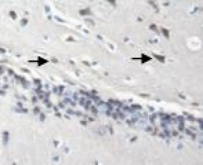 Functional Electrical Stimulation