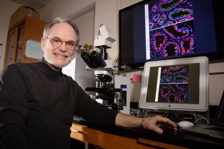 Rex Hess, 	University of Illinois