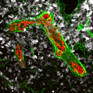 How immune cells fight lymphoma