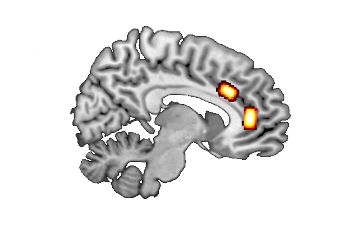 Brain section