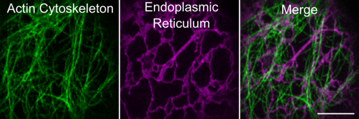 Joe McKenna research