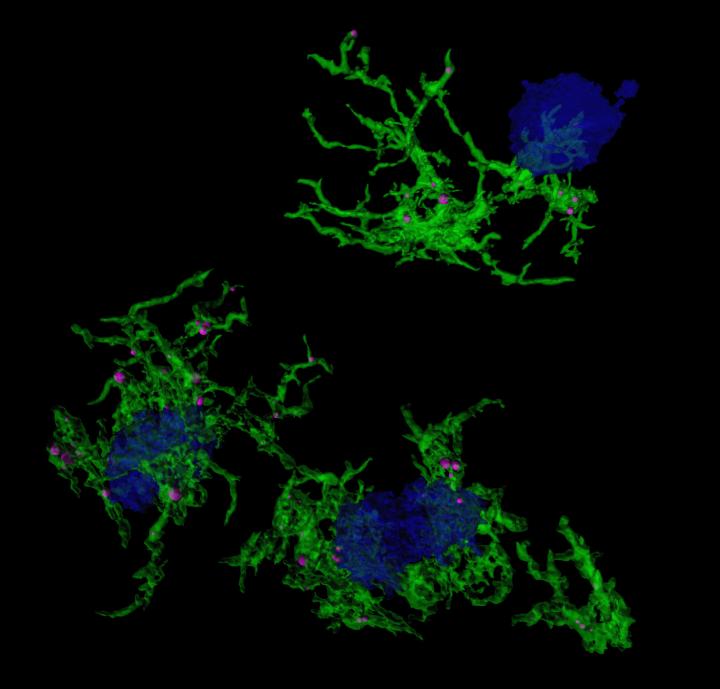 Plaque-eating microglia