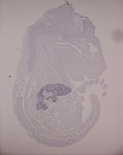 miRNA Involved in Red Blood Cell Production