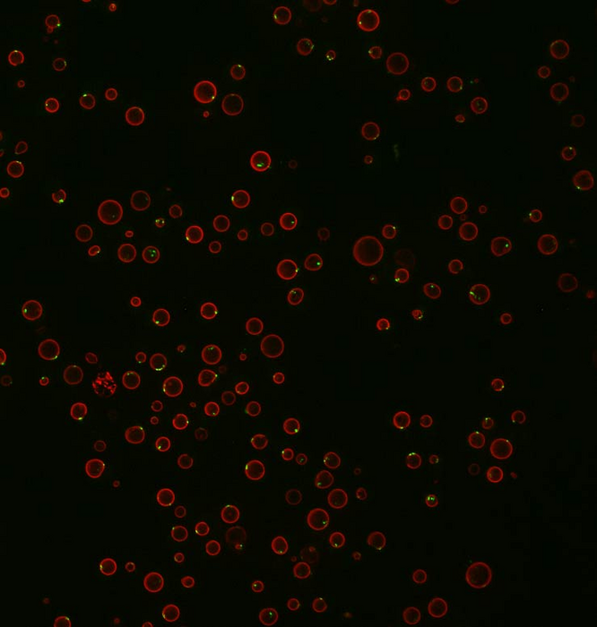 Yeasts under a microscope