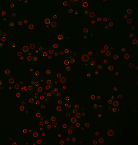 Yeasts under a microscope