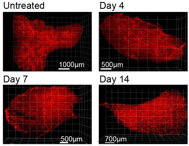 New Insights into the Thymus' Self-repair Process (2 of 6)