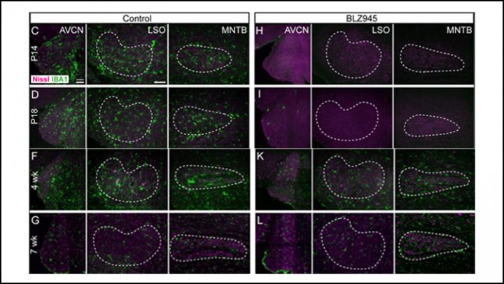 Auditory Brainstem Pathways Do Not Develop Properly Without Microglia