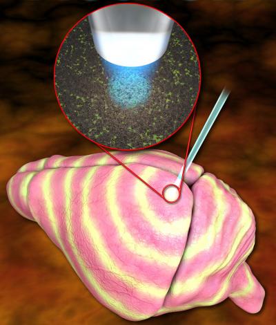 Origin and Propagation of Induced Slow Waves