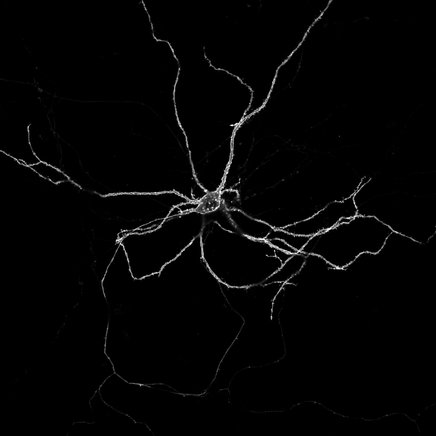 Image of a living nerve cell grown in the lab: