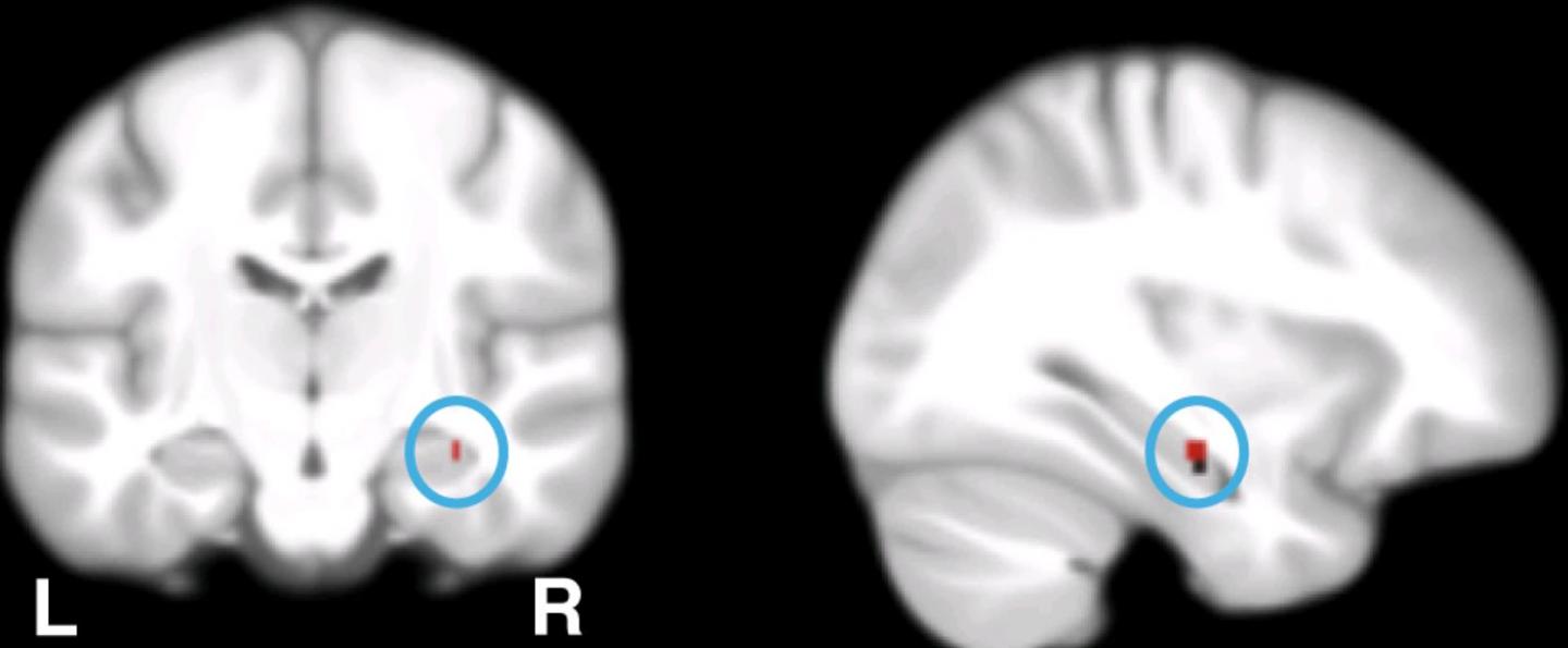 Calcium-Regulating Genes