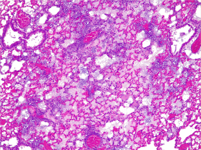 Pulmones de ratón con una infección aguda farmacorresistente y sin efecto terapéutico de la 'píldora viva'