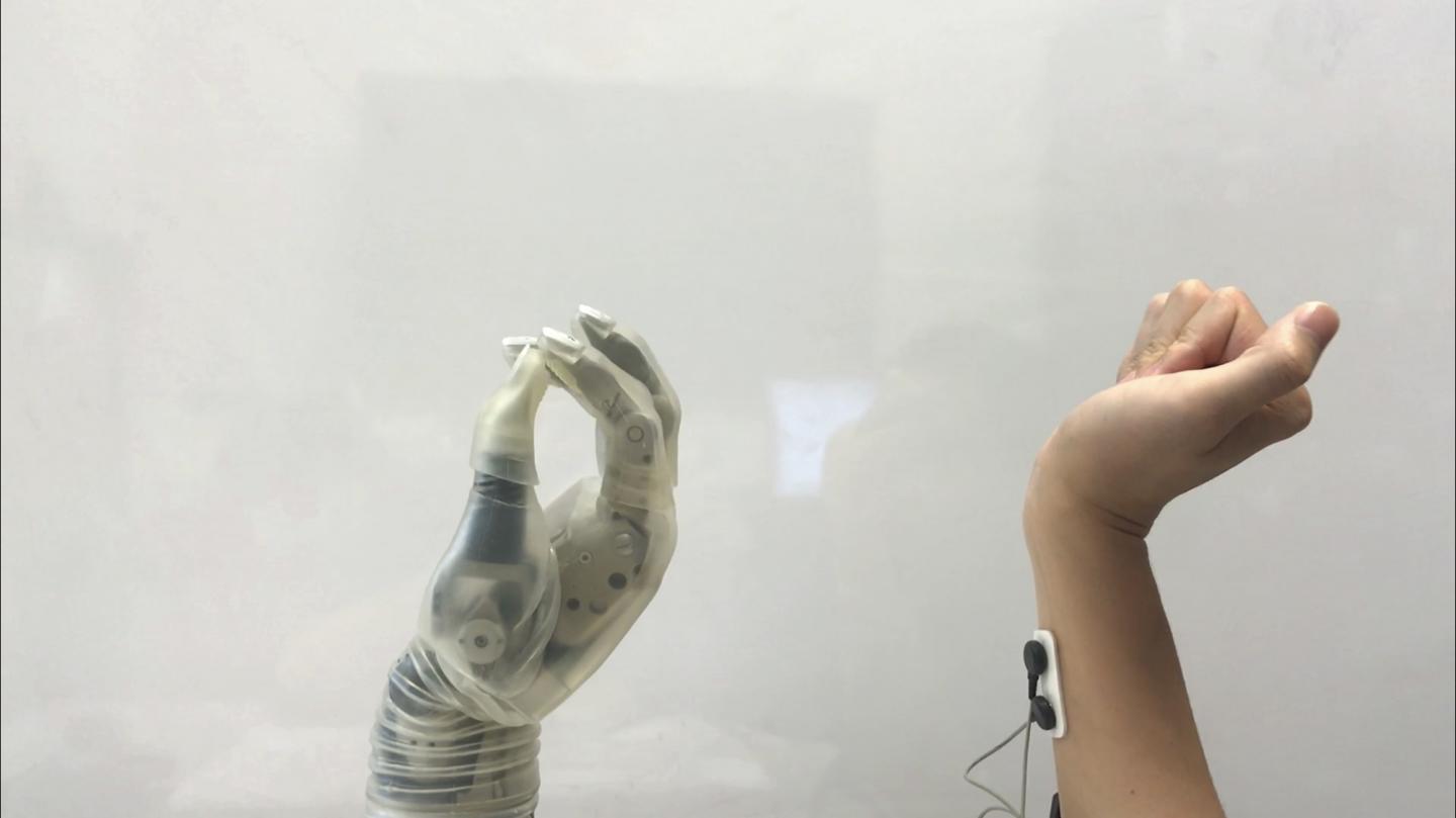 More User-Friendly Powered Prosthetics