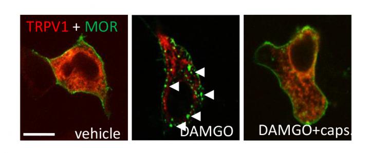 Why Does Inflammation Enhance Pain Relief from Opioids? (2 of 2)