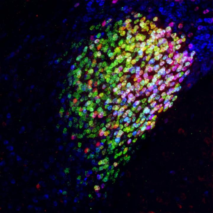 Central Amygdala's Pain Center