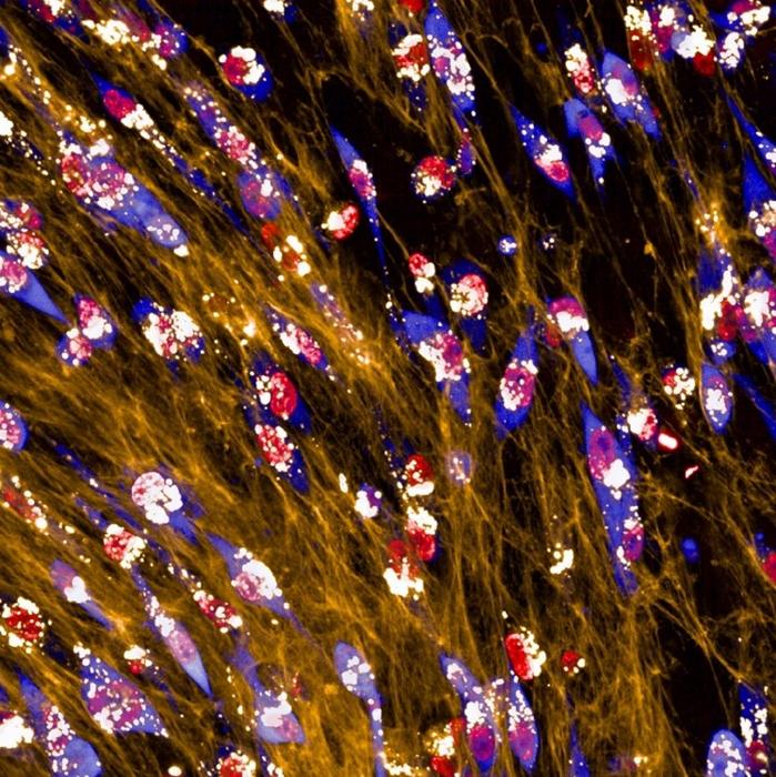 Breast cancer cells (in blue) eating extracellular matrix
