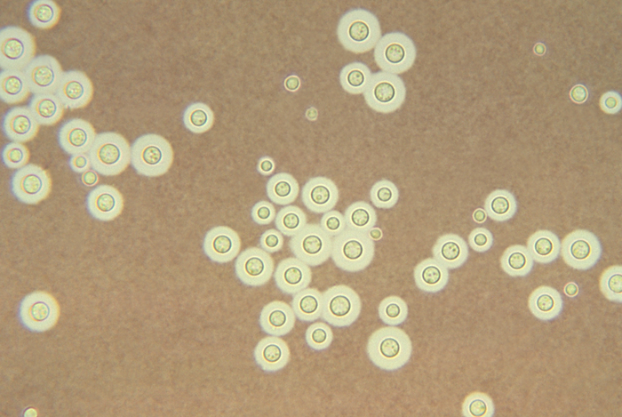Photomicrograph of Cryptococcus deneoformans