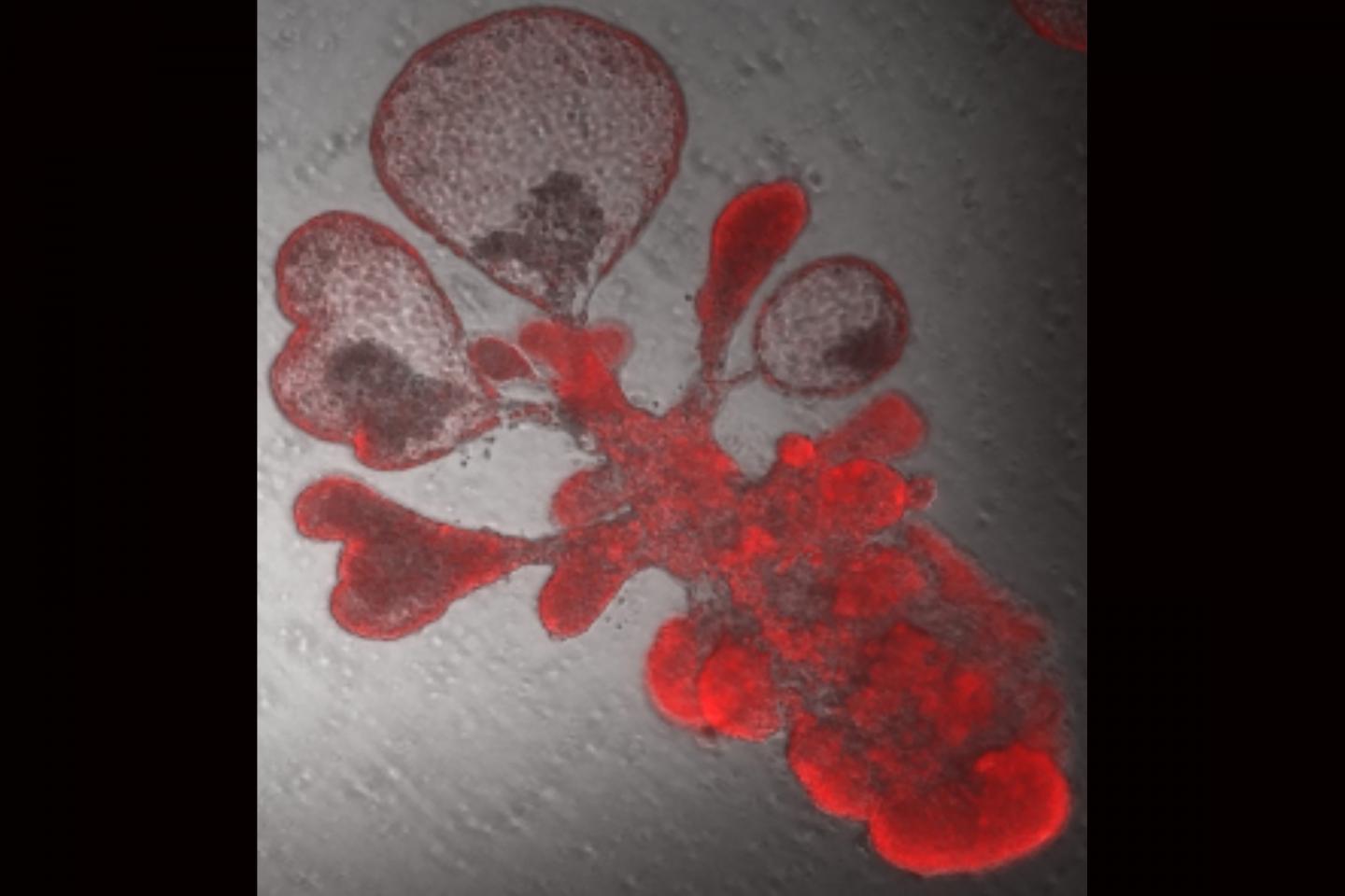 Human alveoli from a single stem cell