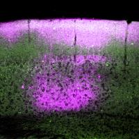 pink and green neurons 2