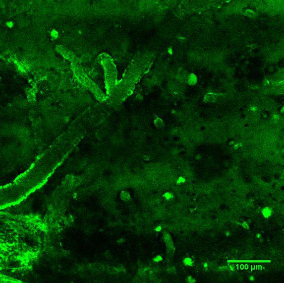 The Specific VHH Antibody for Plaques