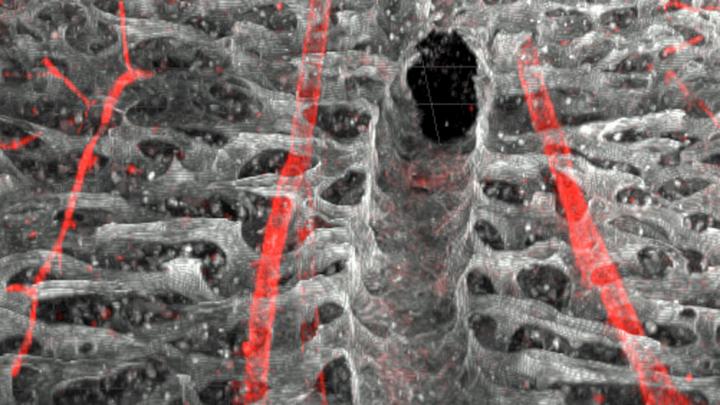 Innate Reaction of Hematopoietic Stem Cells to Severe Infections
