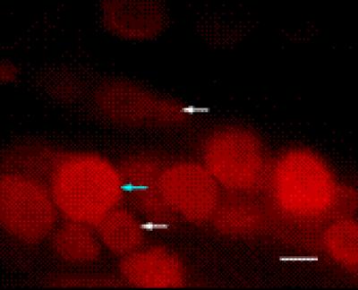 Melatonin Receptor 1-Positive