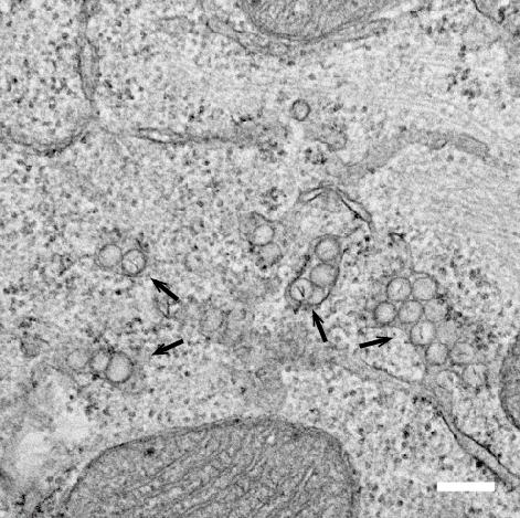 Zika Virus Replication Compartments