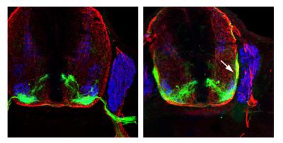 Motor Neuron Growth