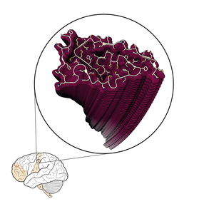 TDP-43 filament and brain diagram