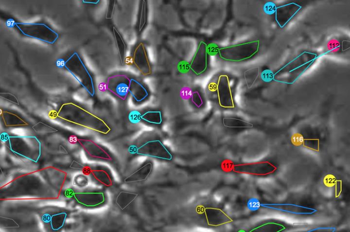 Image Tracking Neural Stem Cells