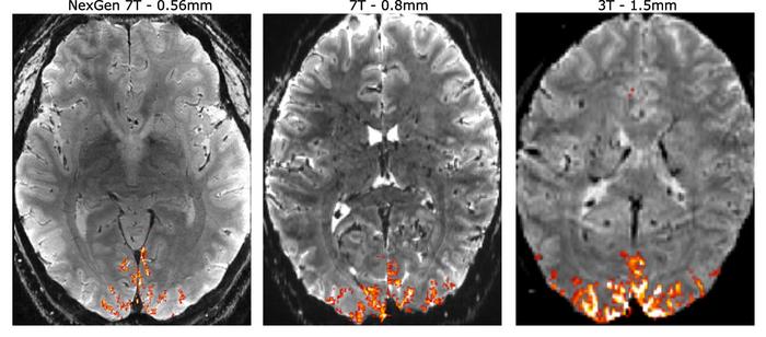Comparison of 3T, 7T and NexGen 7T brain imaging
