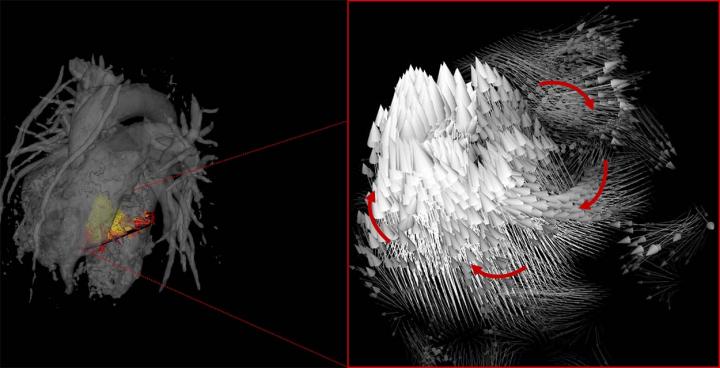 MRI Shows Blood Flow Differs in Men and Women (2 of 2)